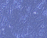 Bladder Epithelial Cells (BEC)