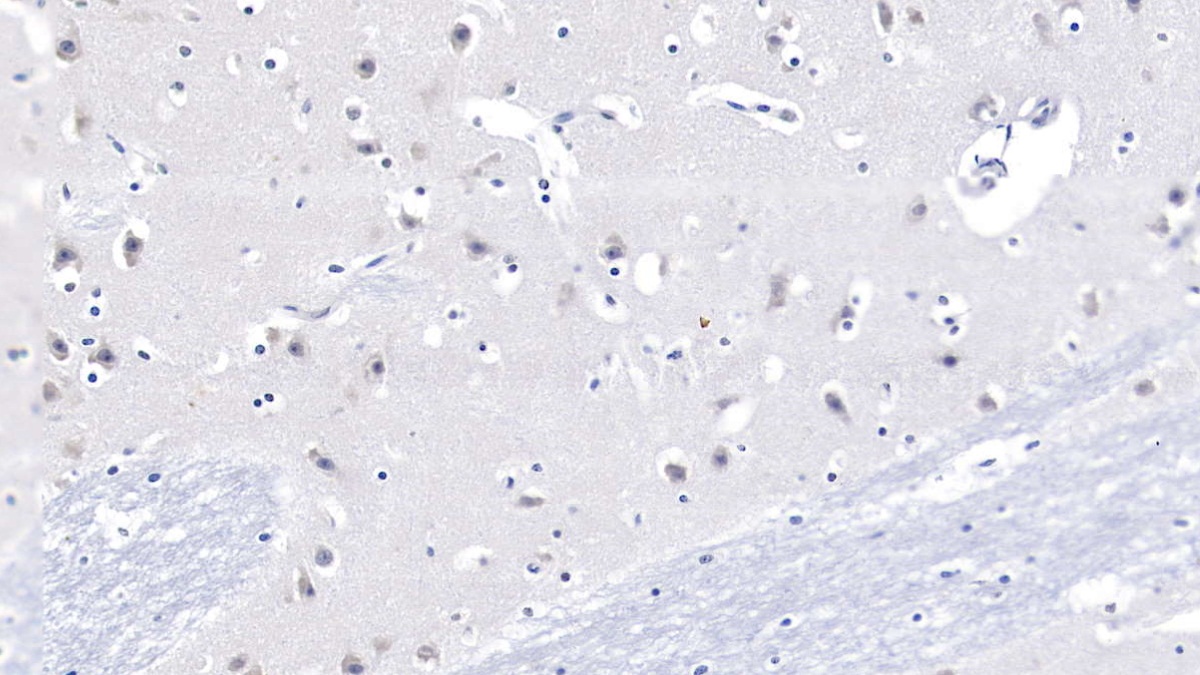 Monoclonal Antibody to Nitric Oxide Synthase 1, Neuronal (NOS1)