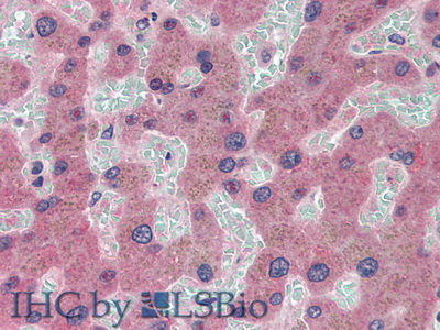 Monoclonal Antibody to Ceruloplasmin (CP)
