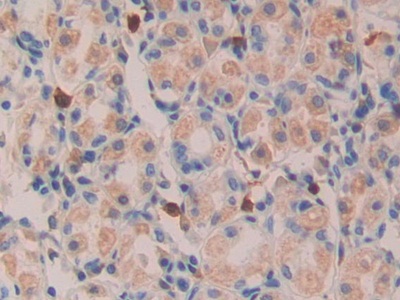 Polyclonal Antibody to Transforming Growth Factor Alpha (TGFa)