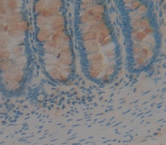 Polyclonal Antibody to Carcinoembryonic Antigen (CEA)