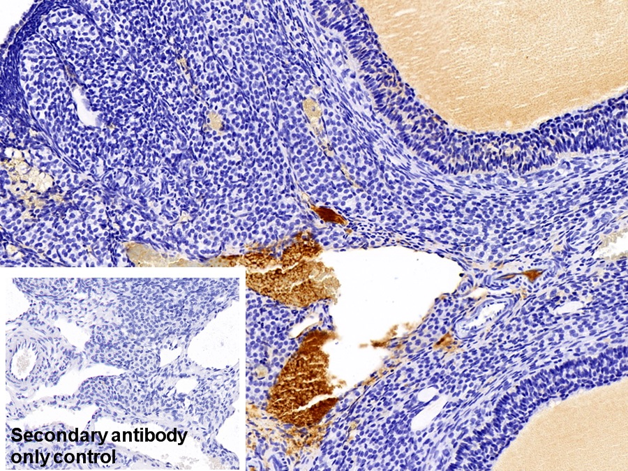 Polyclonal Antibody to Immunoglobulin G (IgG)