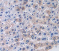 Polyclonal Antibody to Clara Cell Protein 16 (CC16)