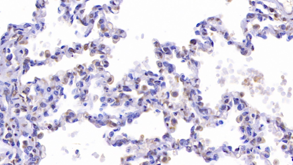 Polyclonal Antibody to Cystic Fibrosis Transmembrane Conductance Regulator (CFTR)