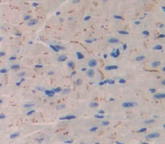 Polyclonal Antibody to Calcium Channel, Voltage Dependent, L-Type, Alpha 1S Subunit (CACNa1S)