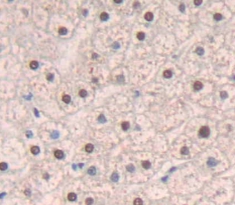 Polyclonal Antibody to Lamin A/C (LMNA)