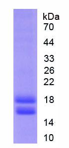 Active Cytochrome P450 1B1 (CYP1B1)