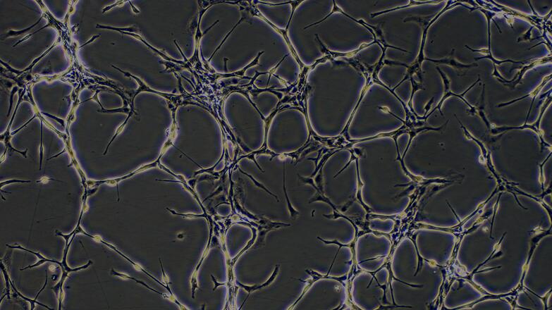 Primary Mouse Aortic Endothelial Cells (AEC)