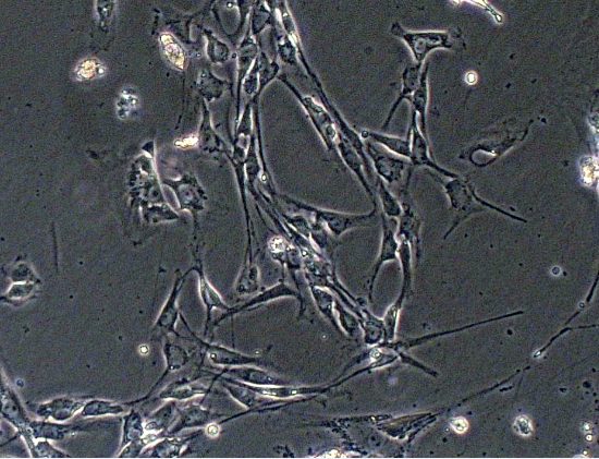 Primary Mouse Thyroid Fibroblasts (TF)