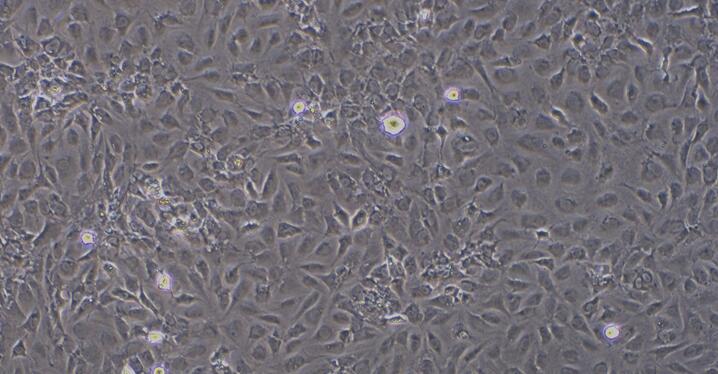 Primary Mouse Dermal Microvascular Endothelial Cells (DMEC)