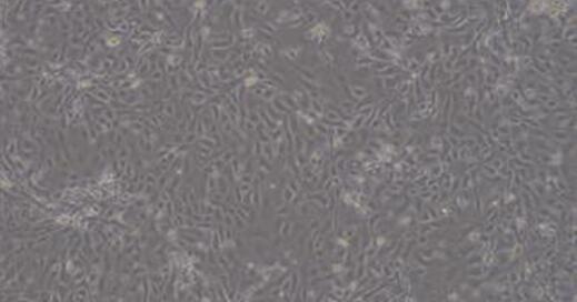 Primary Mouse Cervical Epithelial Cells (CrEC)