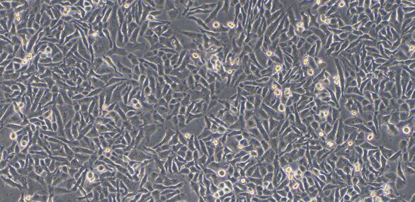 Human Non-Small Cell Lung Carcinoma Cells (LCLC)