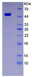Eukaryotic Excision Repair Cross Complementing Rodent Repair Deficiency Complementation 1 (ERCC1)