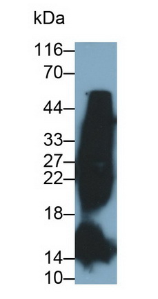 Monoclonal Antibody to Glycated Hemoglobin A1c (HbA1c)