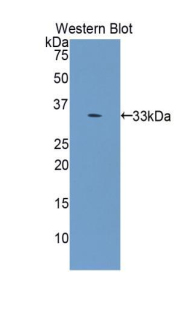 FITC-Linked Monoclonal Antibody to Chitinase-3-like Protein 1 (CHI3L1)