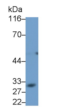 Monoclonal Antibody to Cluster Of Differentiation 23 (CD23)