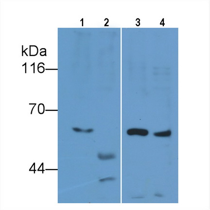 Monoclonal Antibody to Interleukin 7 Receptor (IL7R)