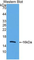 Monoclonal Antibody to Mitochondrial Uncoupling Protein 2 (UCP2)