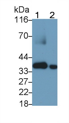 Monoclonal Antibody to Annexin A3 (ANXA3)