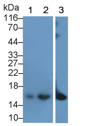 Monoclonal Antibody to Cellular Retinoic Acid Binding Protein 2 (CRABP2)