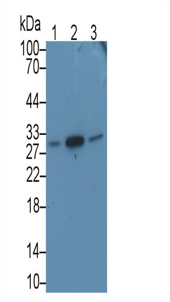 Monoclonal Antibody to Microtubule Associated Protein RP/EB Family, Member 1 (MAPRE1)