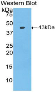 Polyclonal Antibody to Bone Morphogenetic Protein 2 (BMP2)