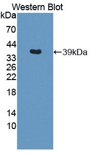 Polyclonal Antibody to Interleukin 12B (IL12B)