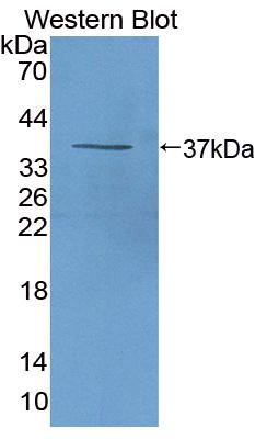 Polyclonal Antibody to Chemokine (C-X-C motif) ligand 7 ( CXCL7)