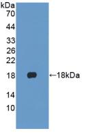 Polyclonal Antibody to Cytokeratin 1 (CK1)
