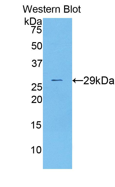 Polyclonal Antibody to Dihydrolipoyl Transacetylase (DLAT)