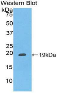 Polyclonal Antibody to Chemokine C-X-C-Motif Ligand 16 (CXCL16)