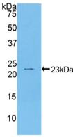 Polyclonal Antibody to Heat Shock Protein Beta 2 (HSPb2)