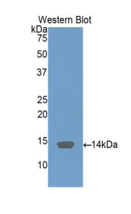 Polyclonal Antibody to Serum Amyloid A (SAA)