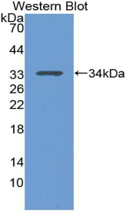 Polyclonal Antibody to Tumor Protein p53 (P53)