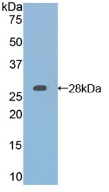 Polyclonal Antibody to Retinoic Acid Receptor Alpha (RARa)