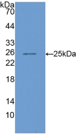 Polyclonal Antibody to Cartilage Oligomeric Matrix Protein (COMP)
