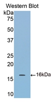 Polyclonal Antibody to Cartilage Oligomeric Matrix Protein (COMP)