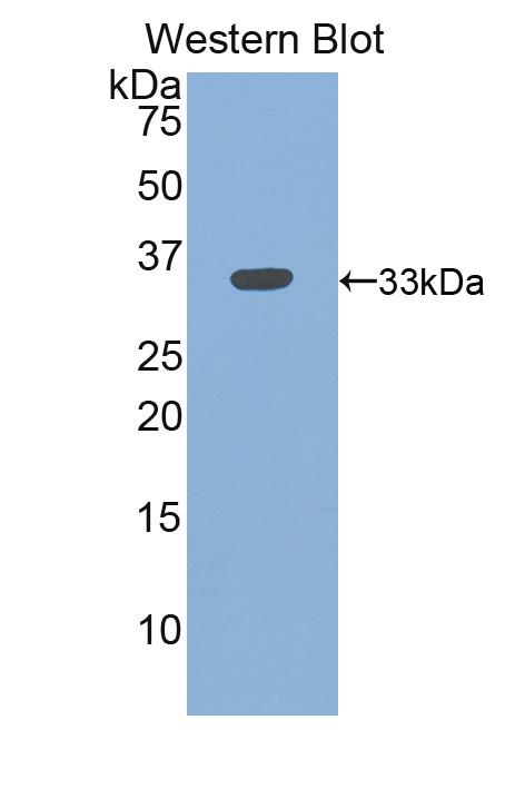Polyclonal Antibody to Integrin Beta 3 (ITGb3)