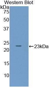 Polyclonal Antibody to Pituitary Adenylate Cyclase Activating Peptide (PACAP)