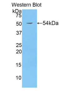 Polyclonal Antibody to Breast Cancer Susceptibility Protein 1 (BRCA1)
