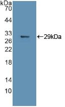 Polyclonal Antibody to Mitogen Activated Protein Kinase 11 (MAPK11)