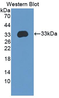 Polyclonal Antibody to Integrin Beta 4 (ITGb4)