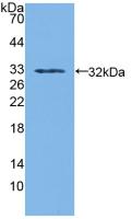 Polyclonal Antibody to Sorbitol Dehydrogenase (SDH)