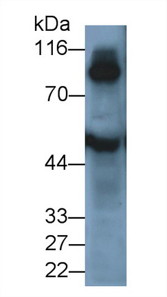 Polyclonal Antibody to Transglutaminase 1 (TGM1)