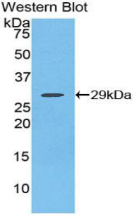 Polyclonal Antibody to Fibroblast Growth Factor Receptor 2 (FGFR2)