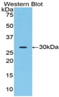 Polyclonal Antibody to Acrosin (ACR)