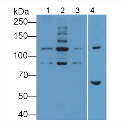 Polyclonal Antibody to Protein Kinase N2 (PKN2)