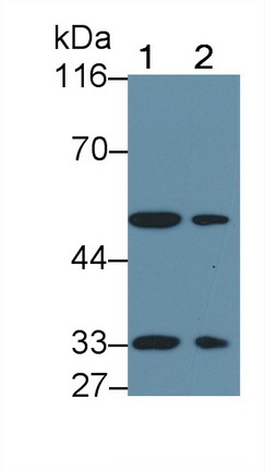 Polyclonal Antibody to Activin A Receptor Type II B (ACVR2B)