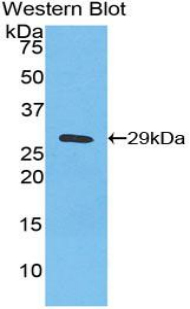 Polyclonal Antibody to Inhibitory Subunit Of NF Kappa B Zeta (IkBz)