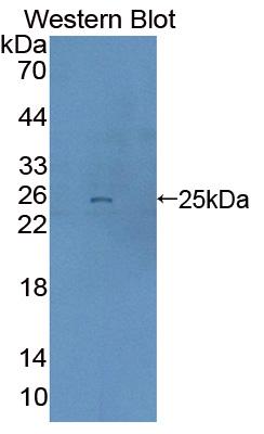 Polyclonal Antibody to Dystrobrevin Binding Protein 1 (DTNBP1)